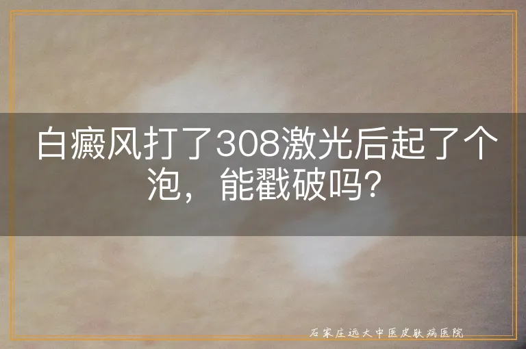 白癜风打了308激光后起了个泡，能戳破吗？