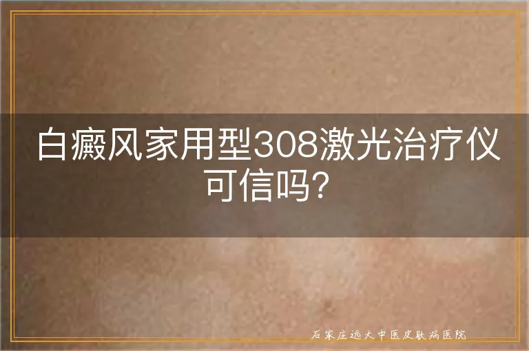 白癜风家用型308激光治疗仪可信吗？