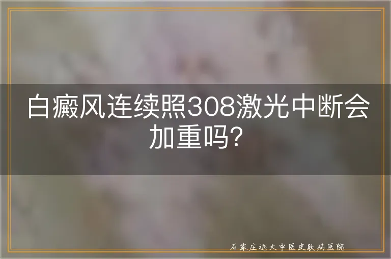 白癜风连续照308激光中断会加重吗？