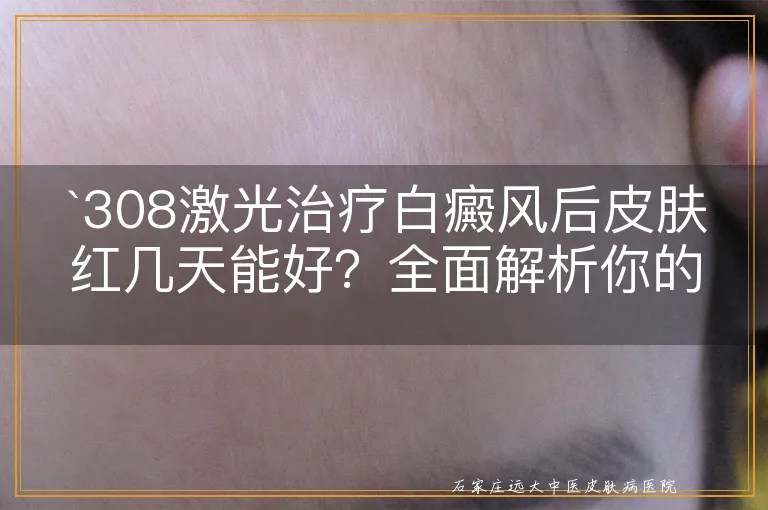 `308激光治疗白癜风后皮肤红几天能好？全面解析你的疑惑`