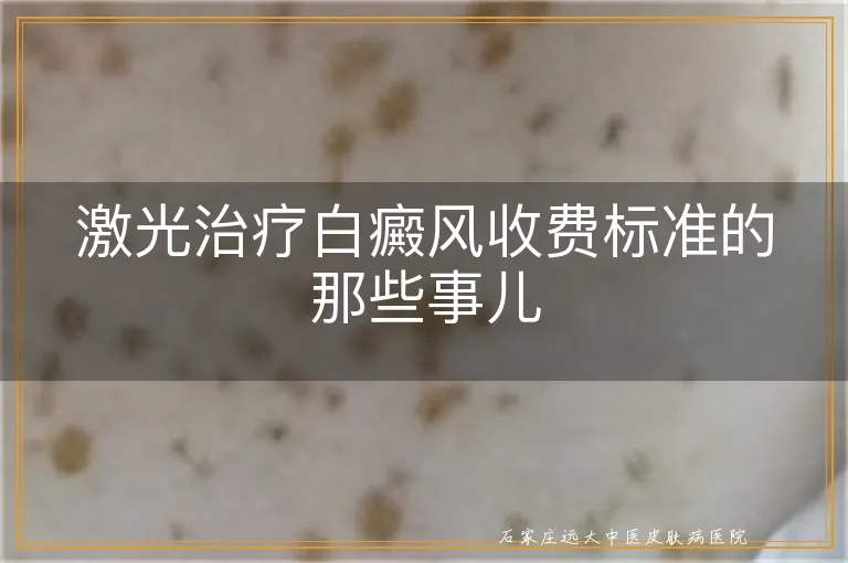 激光治疗白癜风收费标准的那些事儿