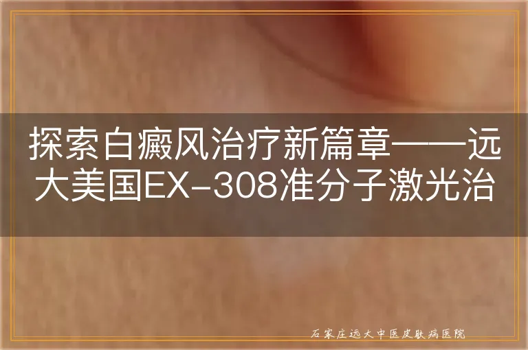 探索白癜风治疗新篇章——远大美国EX-308准分子激光治疗系统