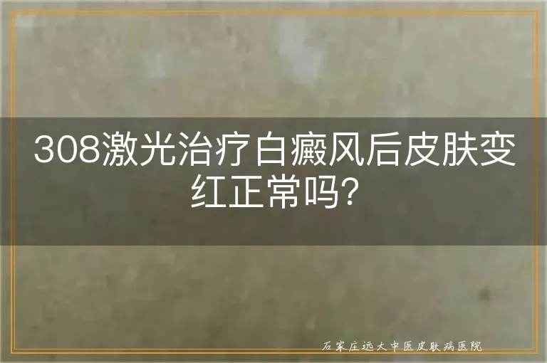 308激光治疗白癜风后皮肤变红正常吗？