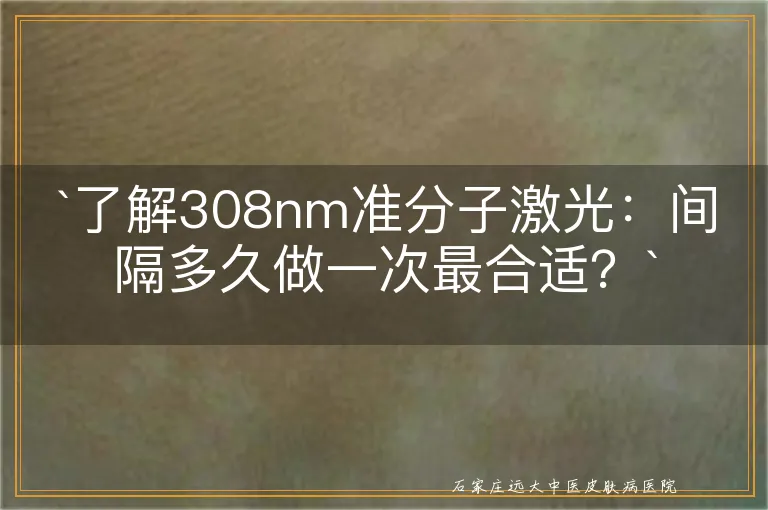 `了解308nm准分子激光：间隔多久做一次最合适？`