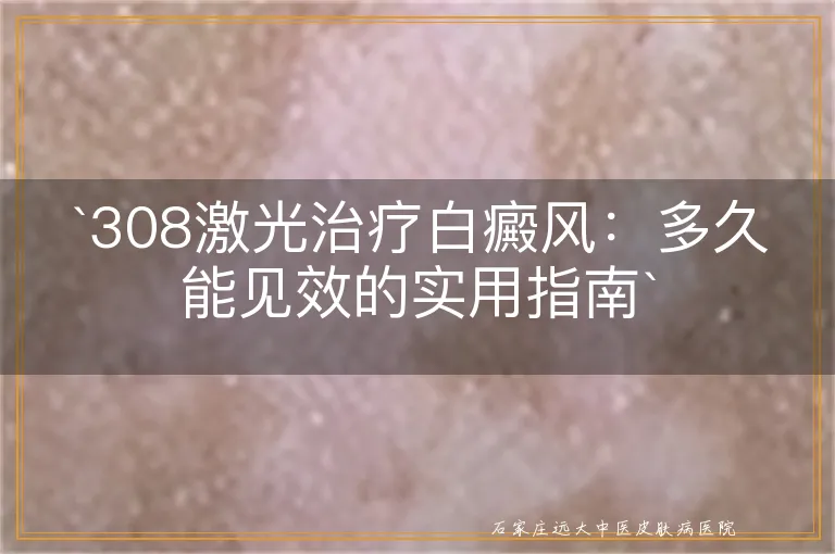 `308激光治疗白癜风：多久能见效的实用指南`