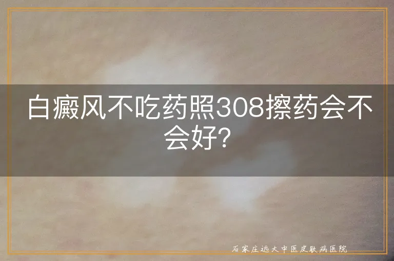 白癜风不吃药照308擦药会不会好？