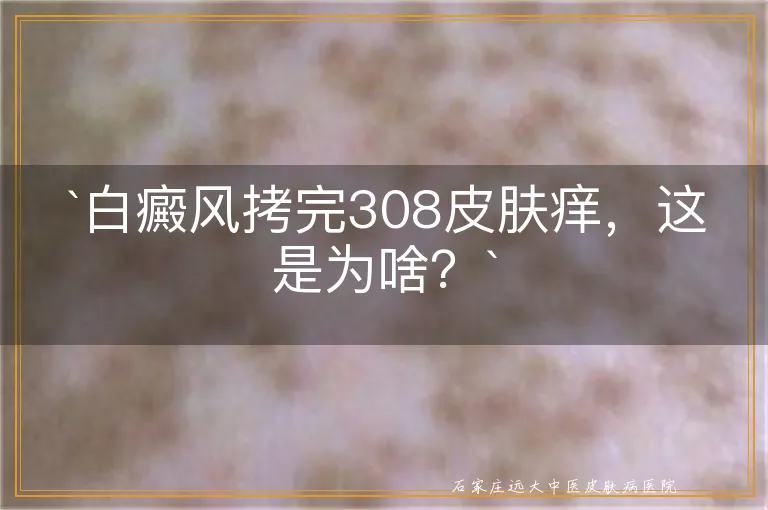 `白癜风拷完308皮肤痒，这是为啥？`