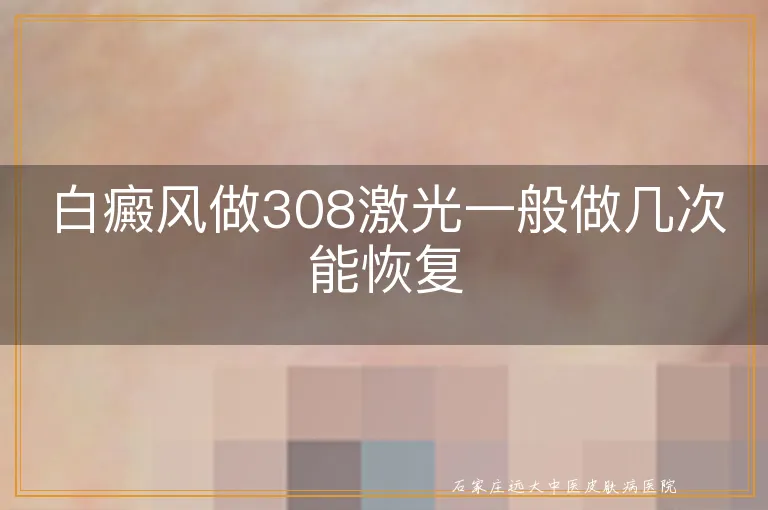 白癜风做308激光一般做几次能恢复