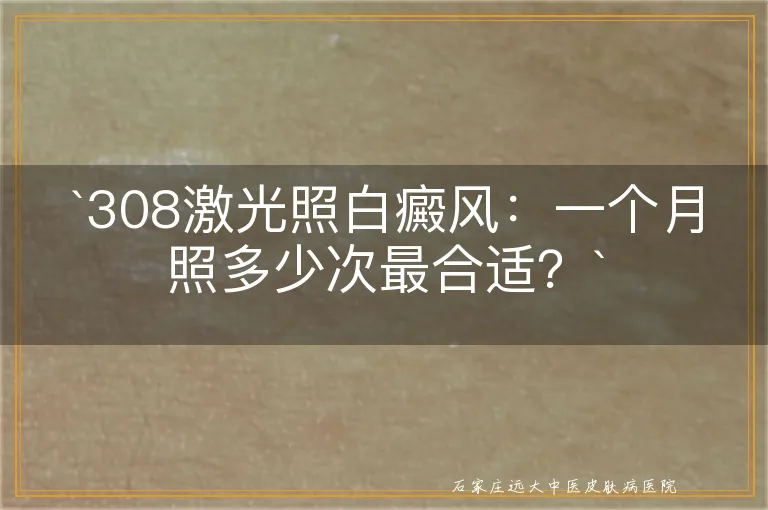 `308激光照白癜风：一个月照多少次最合适？`