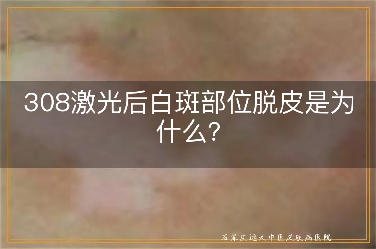 308激光后白斑部位脱皮是为什么？