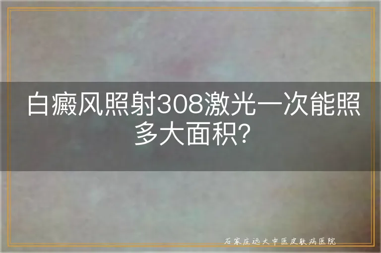 白癜风照射308激光一次能照多大面积？