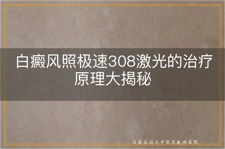 白癜风照极速308激光的治疗原理大揭秘