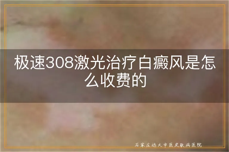 极速308激光治疗白癜风是怎么收费的