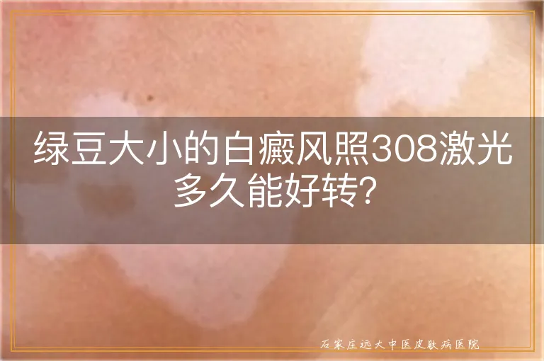 绿豆大小的白癜风照308激光多久能好转？