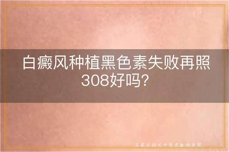 白癜风种植黑色素失败再照308好吗？