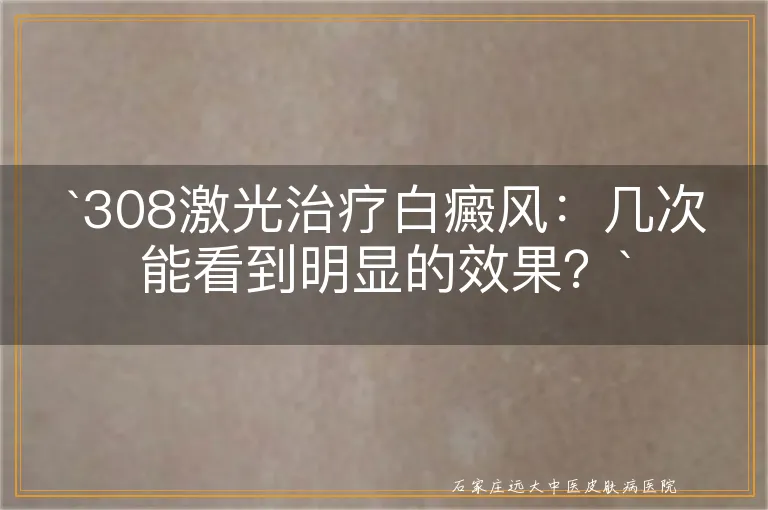 `308激光治疗白癜风：几次能看到明显的效果？`