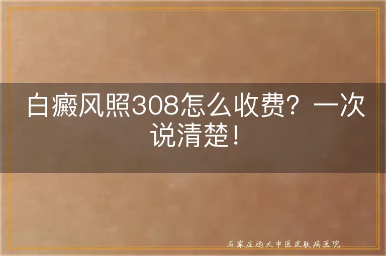 白癜风照308怎么收费？一次说清楚！