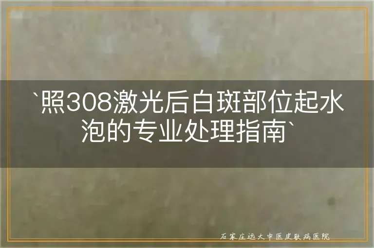 `照308激光后白斑部位起水泡的专业处理指南`