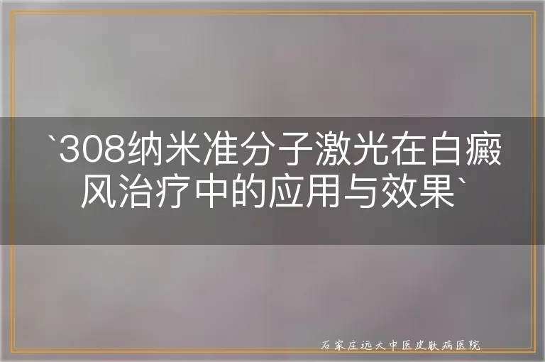 `308纳米准分子激光在白癜风治疗中的应用与效果`