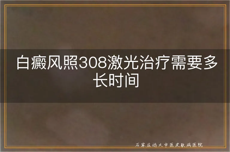 白癜风照308激光治疗需要多长时间