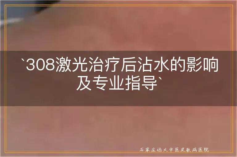 `308激光治疗后沾水的影响及专业指导`