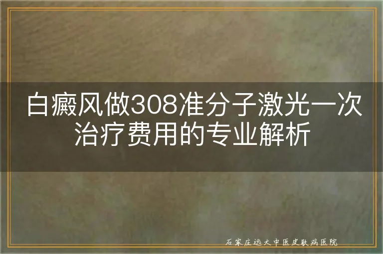 白癜风做308准分子激光一次治疗费用的专业解析