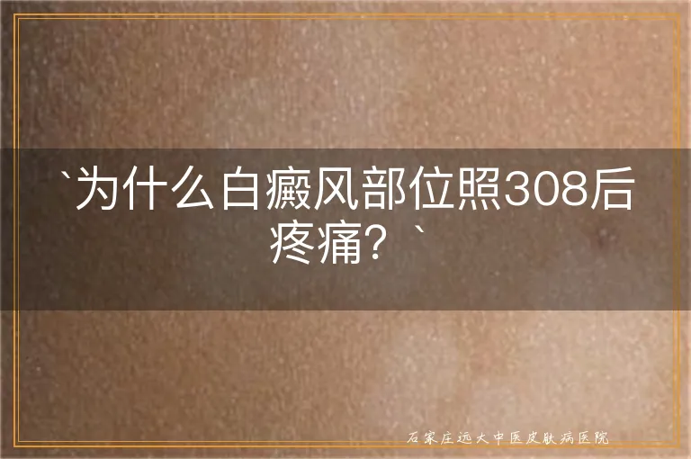 `为什么白癜风部位照308后疼痛？`