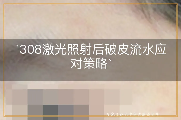 `308激光照射后破皮流水应对策略`