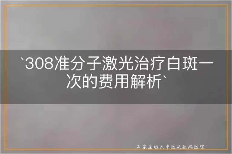 `308准分子激光治疗白斑一次的费用解析`