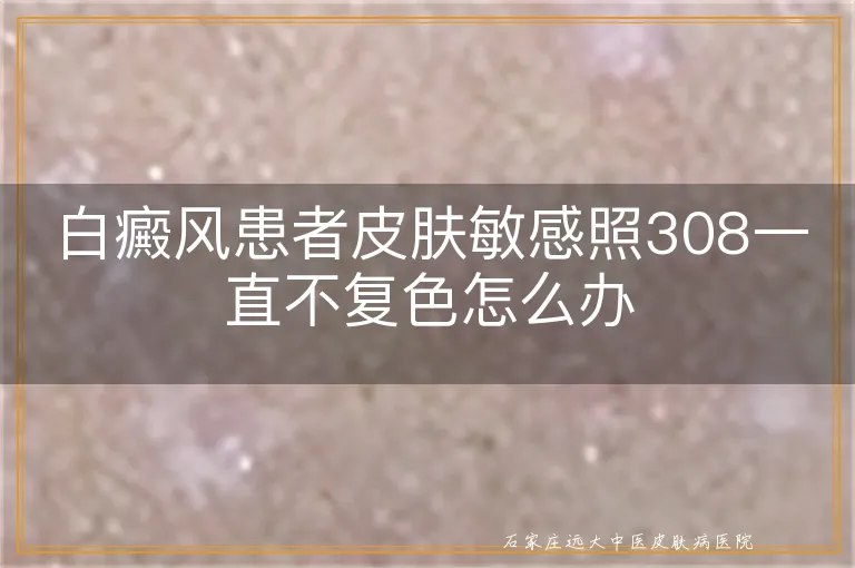 白癜风患者皮肤敏感照308一直不复色怎么办