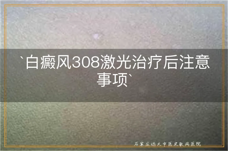 `白癜风308激光治疗后注意事项`