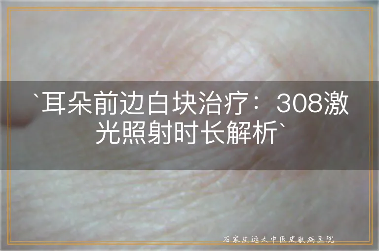 `耳朵前边白块治疗：308激光照射时长解析`