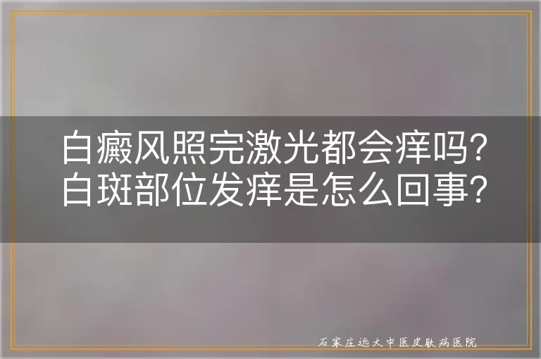 白癜风照完激光都会痒吗？白斑部位发痒是怎么回事？