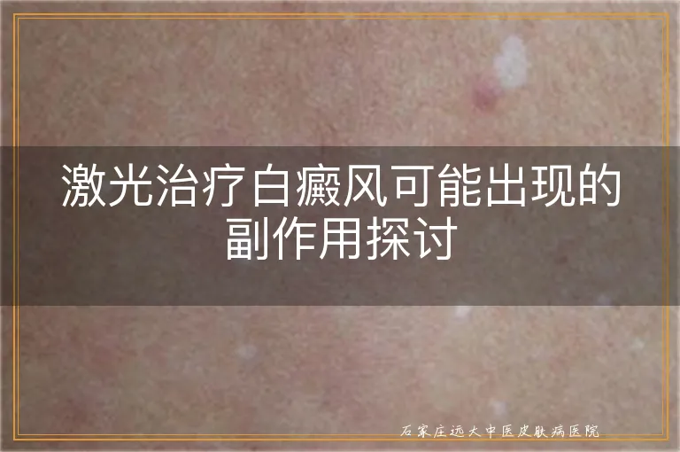 激光治疗白癜风可能出现的副作用探讨