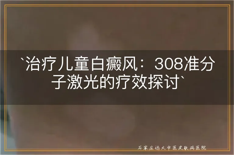 `治疗儿童白癜风：308准分子激光的疗效探讨`