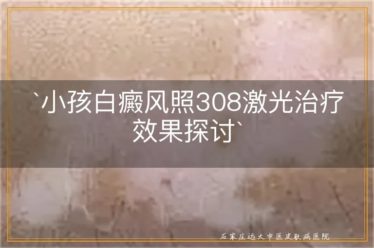 `小孩白癜风照308激光治疗效果探讨`