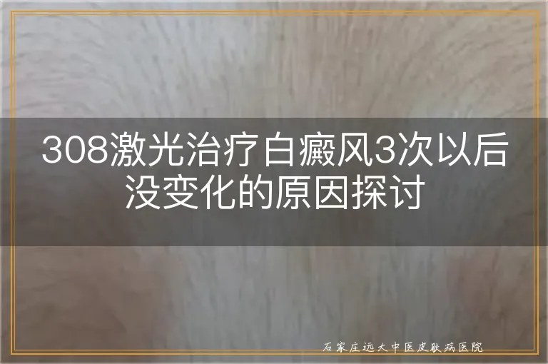 308激光治疗白癜风3次以后没变化的原因探讨