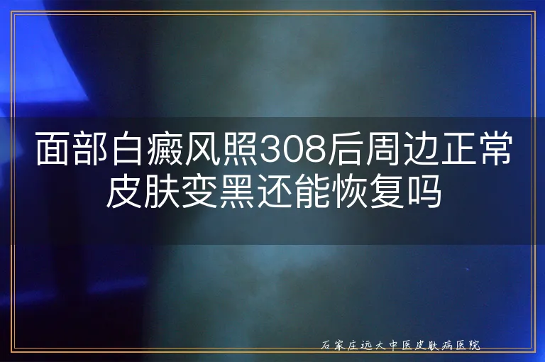 面部白癜风照308后周边正常皮肤变黑还能恢复吗