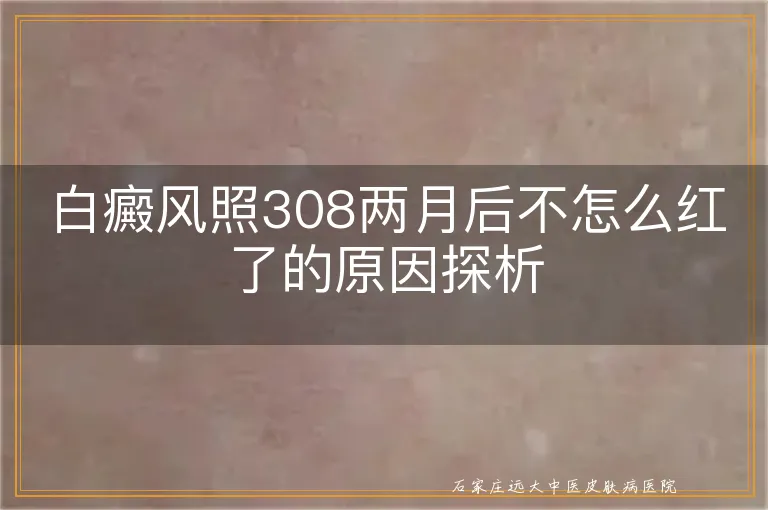 白癜风照308两月后不怎么红了的原因探析