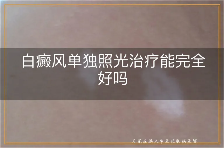 白癜风单独照光治疗能完全好吗