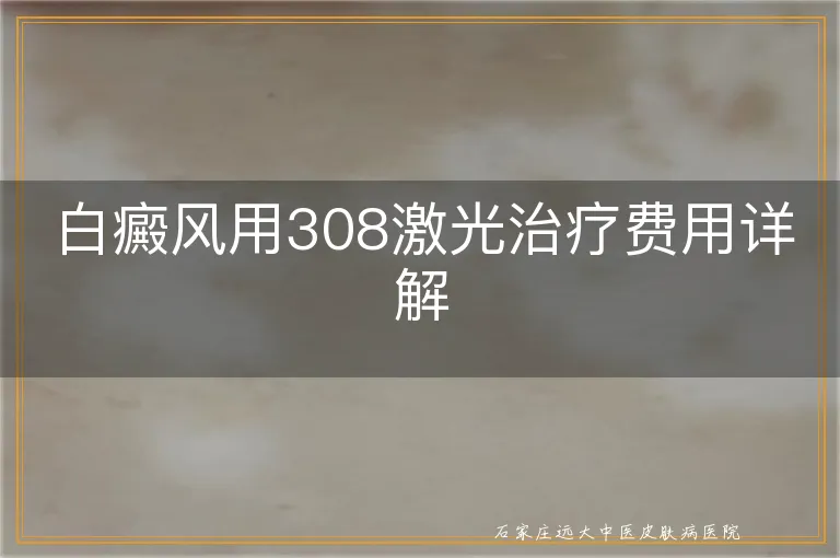 白癜风用308激光治疗费用详解