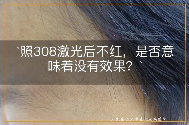 `照308激光后不红，是否意味着没有效果？`