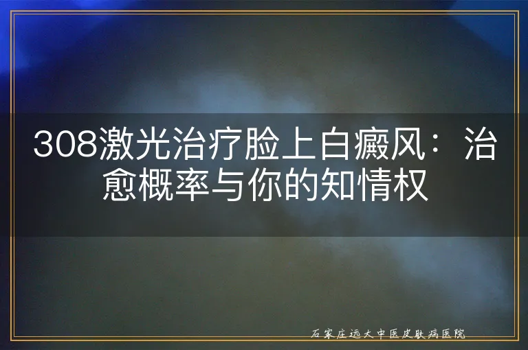 308激光治疗脸上白癜风：治愈概率与你的知情权