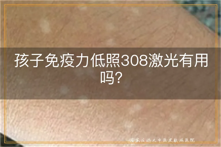 孩子免疫力低照308激光有用吗？