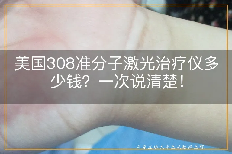 美国308准分子激光治疗仪多少钱？一次说清楚！