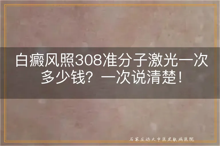 白癜风照308准分子激光一次多少钱？一次说清楚！