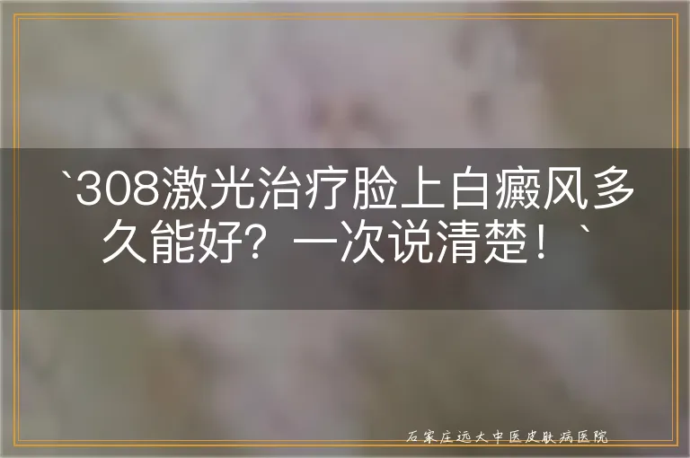 `308激光治疗脸上白癜风多久能好？一次说清楚！`