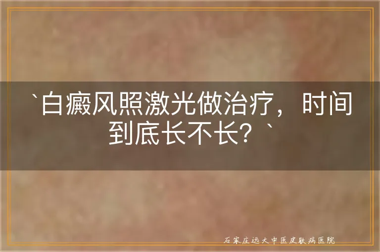 `白癜风照激光做治疗，时间到底长不长？`