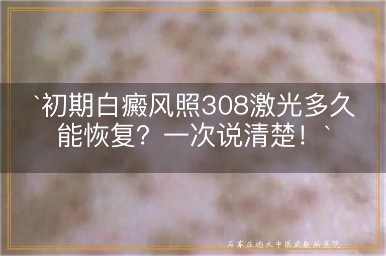 `初期白癜风照308激光多久能恢复？一次说清楚！`