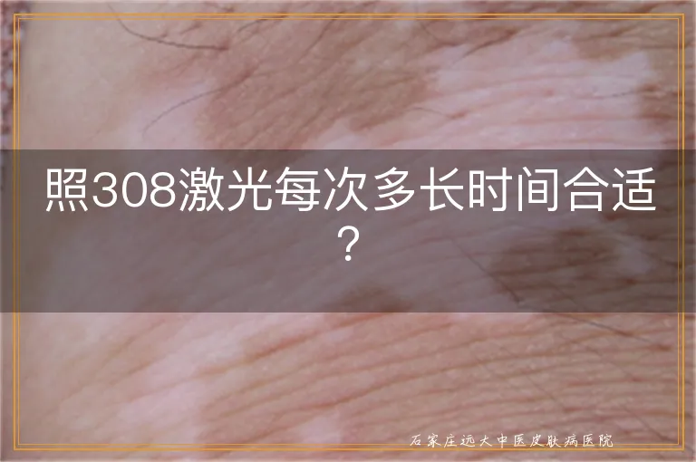 照308激光每次多长时间合适？